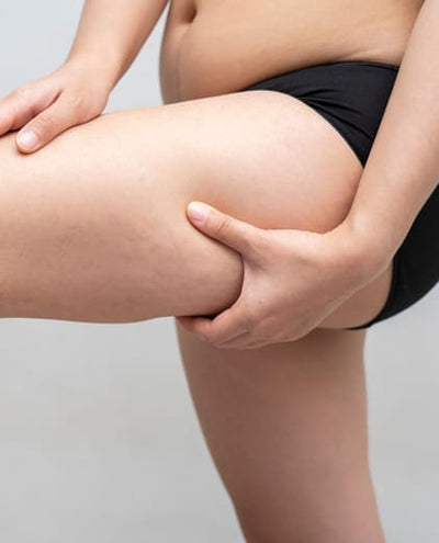 Thighs & inner thighs